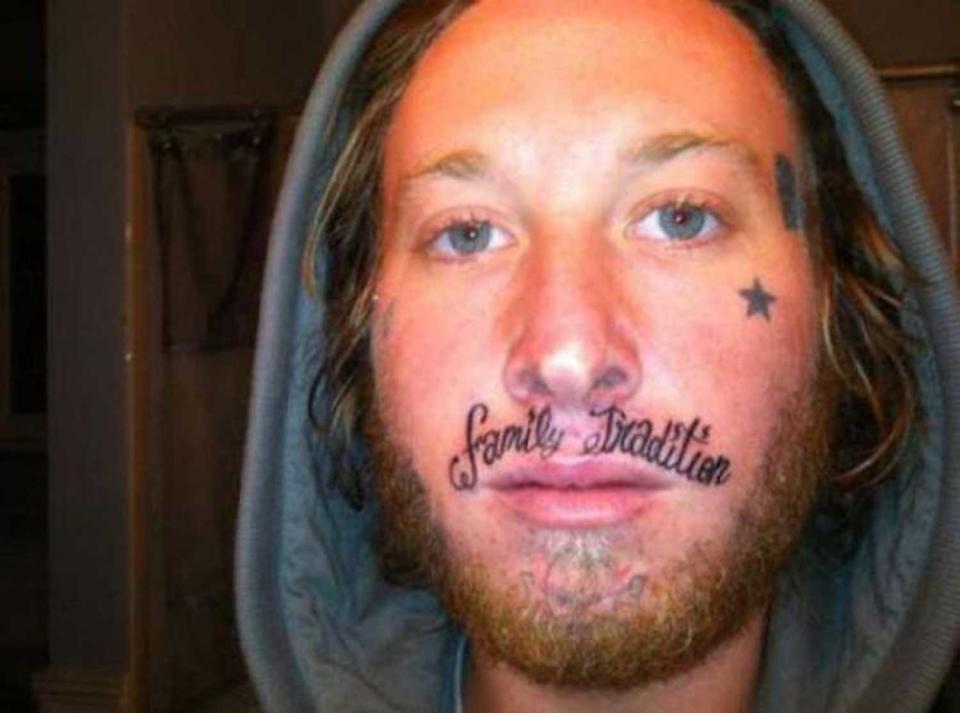 <p>Dieser junge Mann steht auf Tattoos. Nun hat er sich dafür allerdings eine ungewöhnliche Stelle ausgesucht – direkt unter der Nase. So muss er sich zumindest nie mehr einen Schnurrbart wachsen lassen. (Bild: twitter.com/tarpeggio) </p>