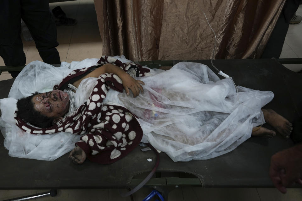 Palestinians wounded in the Israeli bombardment of the Gaza Strip are brought to the hospital in Deir al Balah on Friday, Dec. 8, 2023. (AP Photo/Adel Hana)