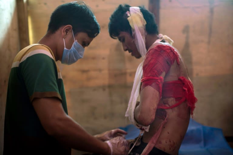 A local doctor working for the Kachin Independence Army (KIA) ethnic group attends to a KIA rebel with shrapnel wounds sustained while fighting the Myanmar military, near Laiza, Kachin State