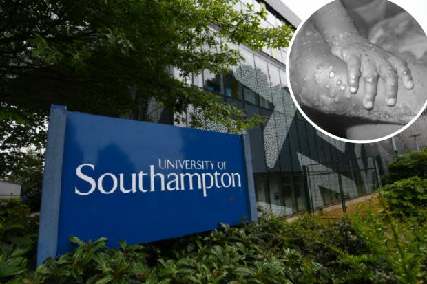 Southampton expert speaks as monkeypox as cases rise