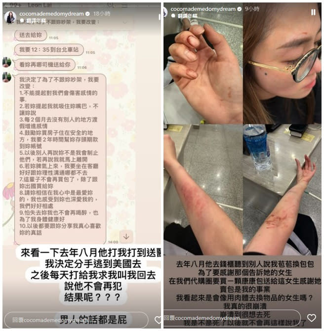 林千又曬出傷勢照，控訴遭富商男友家暴。（圖／cocomademedomydream IG）