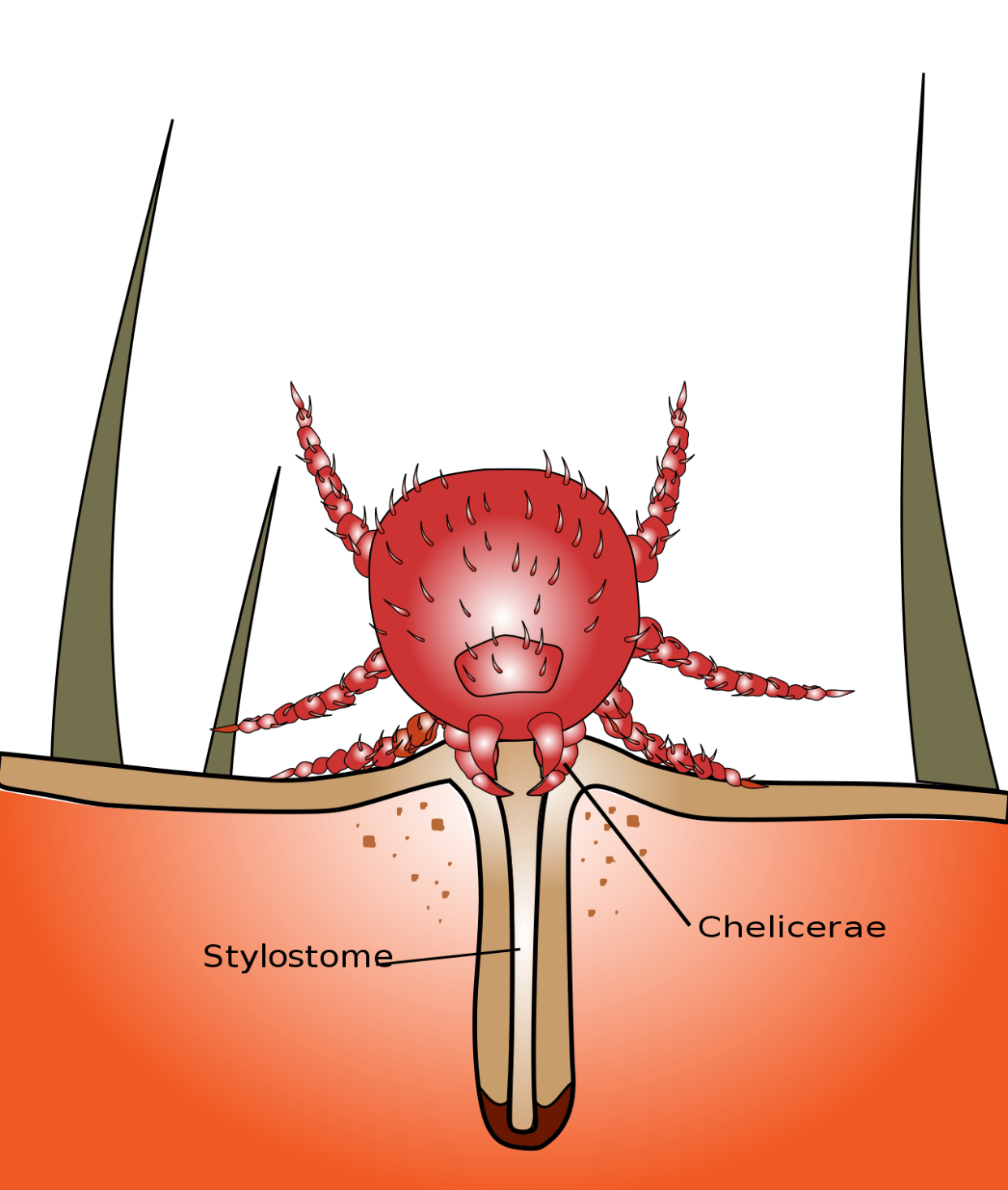 illustration of chigger bite