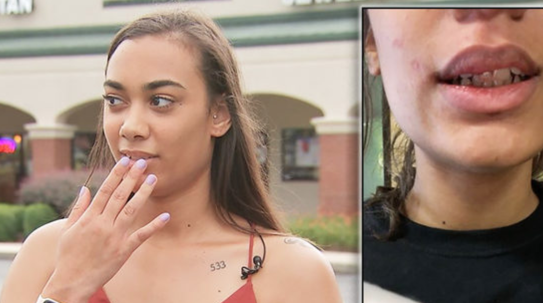 A college student was punched by a customer at Subway after he became irate she verified he was not using a counterfeit bill. (Photo: Channel 9)