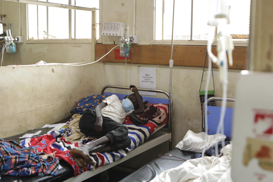 Sickle cell patient John Elugalt lies on a hospital bed inside the emergency room at the Mbale Regional Referral Hospital in Mbale, Uganda, Wednesday, April 24, 2024. There can be lifelong challenges for people with sickle cell disease in rural Uganda, where it remains poorly understood. (AP Photo/Hajarah Nalwadda)