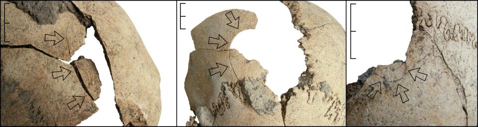 These injuries show the incredible trauma experienced by the victims in the mass grave. <cite>Copyright Christian Meyer</cite>