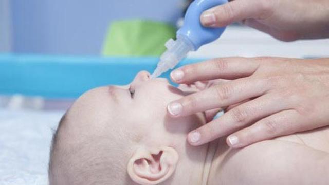 Cara mengatasi hidung tersumbat pada bayi