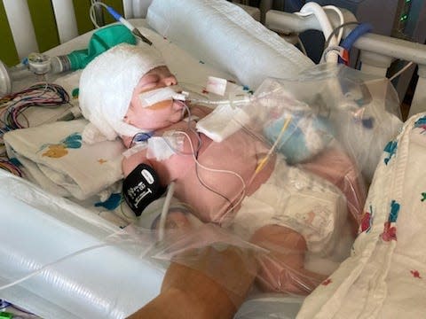 baby ronan in the hospital intubated lying, sleeping