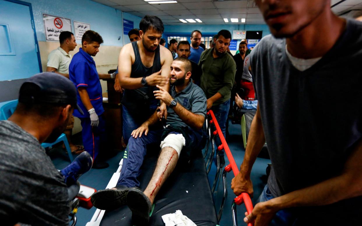  Palestinian injured by Israeli air strikes arrives at al-Shifa hospital in Gaza City on July 14 - AFP