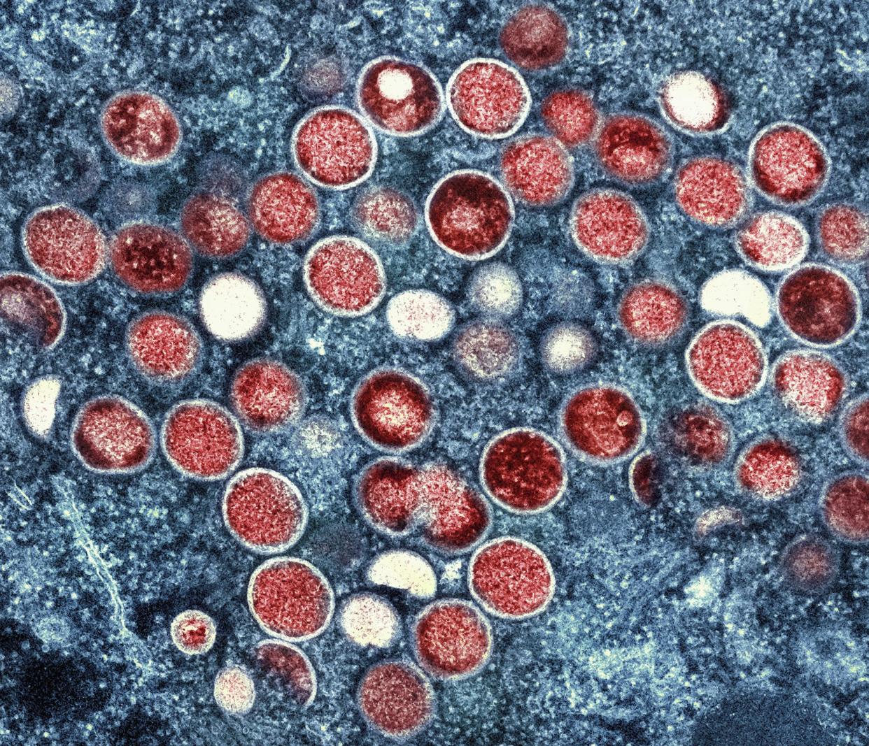 This image shows a colorized transmission electron micrograph of monkeypox particles (red) found within an infected cell (blue).