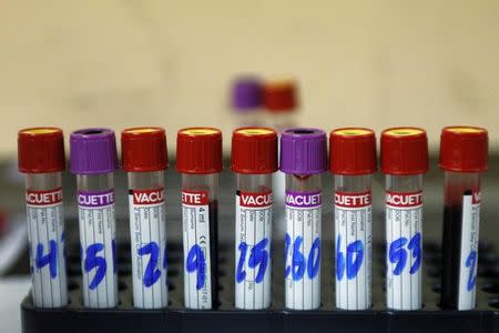 Test tubes with blood samples from patients who have been tested for Zika are seen at the maternity ward of the Hospital Escuela in Tegucigalpa, Honduras April 15, 2016. REUTERS/Jorge Cabrera