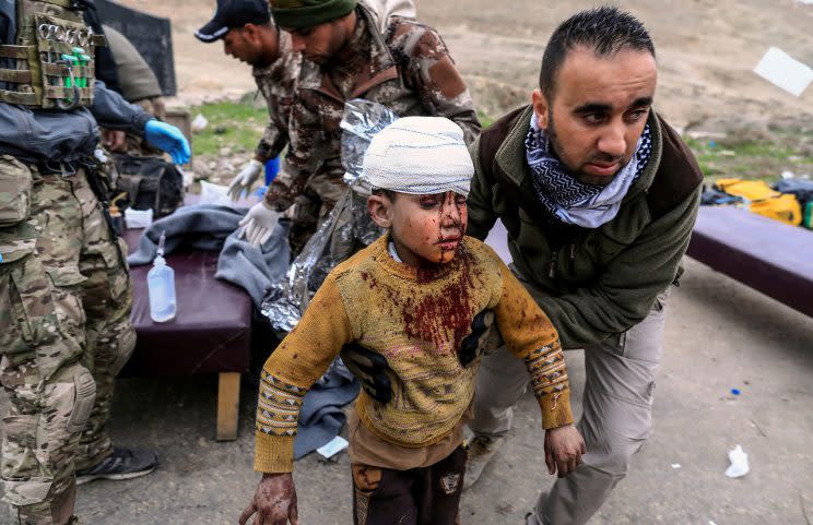Un niño herido en Mosul por fuego de los combates entre la coalición de fuerzas de Irak y EEUU y los milicianos del Estado Islámico. (Reuters/Yahoo News)