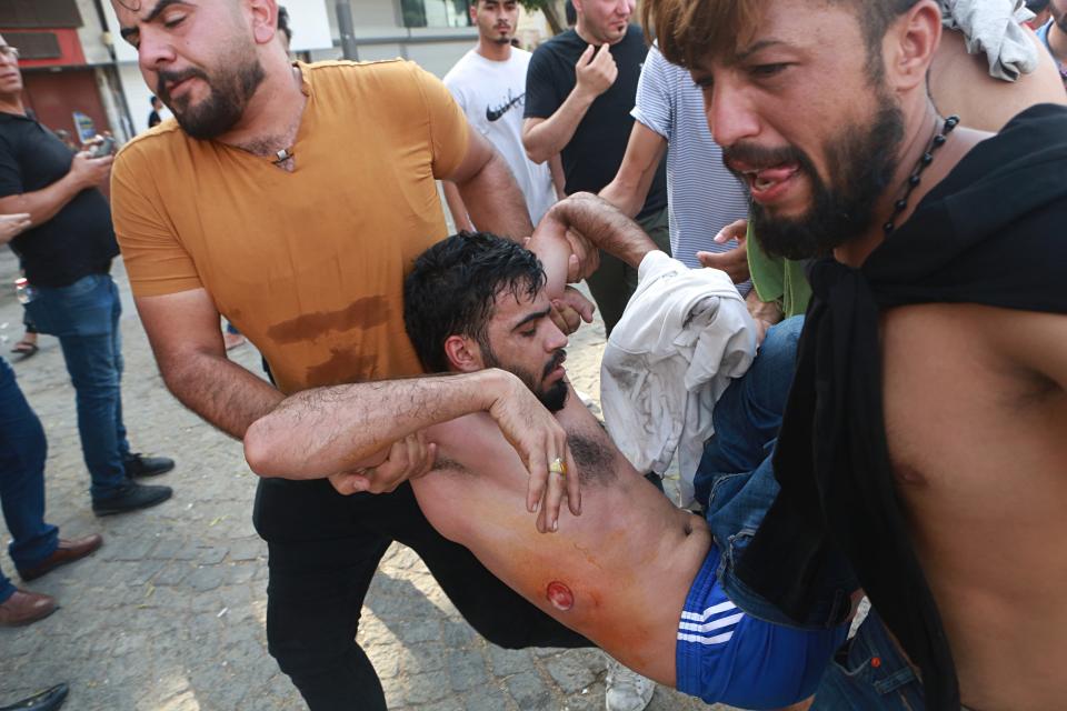 An injured protestor is assisted after being shot by rubber bullets fired by security forces during a protest in Tahrir Square, in central Baghdad, Iraq, Tuesday, Oct. 1, 2019. Iraqi security forces fired rubber bullets and tear gas in Baghdad Tuesday on protesters demonstrating against corruption and poor public services injuring more than a dozen people, medical official said. (AP Photo/Khalid Mohammed)