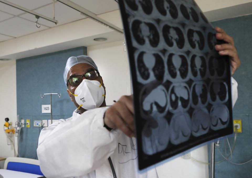 Dr. Kedar Toraskar checks the scan report of a COVID-19 patient at the Mumbai Central Wockhardt Hospital in Mumbai, India, June 4, 2021. The recent coronavirus surge in India affected young people on a scale his team of critical care doctors hadn’t previously seen. Toraskar and his team of ICU doctors are still drained from the incredibly challenging last few months. (AP Photo/Rajanish Kakade)