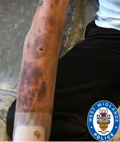 The grandfather received injury to his arm. (West Midlands Police)