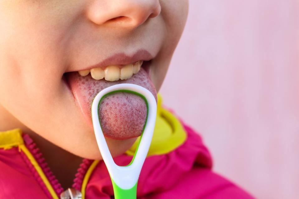 Las bacterias y otros restos atrapados en la lengua pueden causar mal aliento y una decoloración blanca de la lengua. Usar un rascador puede evitarlo. / Foto: Instagram <a href="https://www.instagram.com/taconicdental/" rel="nofollow noopener" target="_blank" data-ylk="slk:taconicdental;elm:context_link;itc:0;sec:content-canvas" class="link ">taconicdental</a>