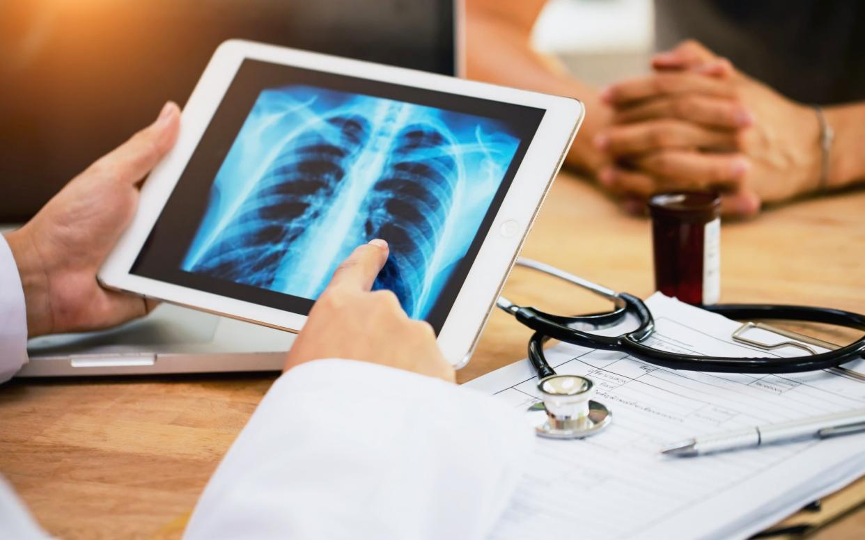 A doctor examines a lung scan - Prapass Pulsub/Moment RF