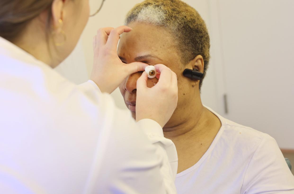 Mattie McCormick, who lost both of her eyes from glaucoma, gets a new set of prosthetics made during her appointment on February 12, 2024.