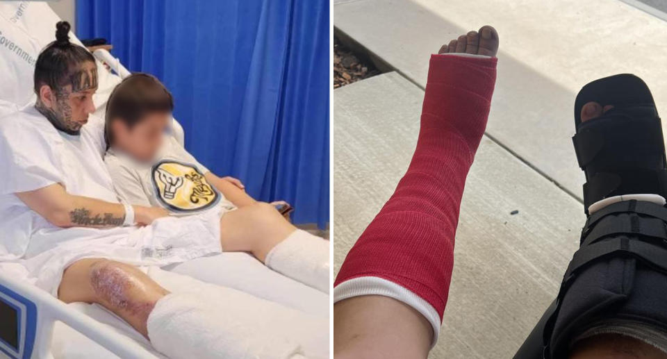 Left: Tia lying in a hospital bed. Right: Shows a picture of her legs, one in a cast and one in a boot. 