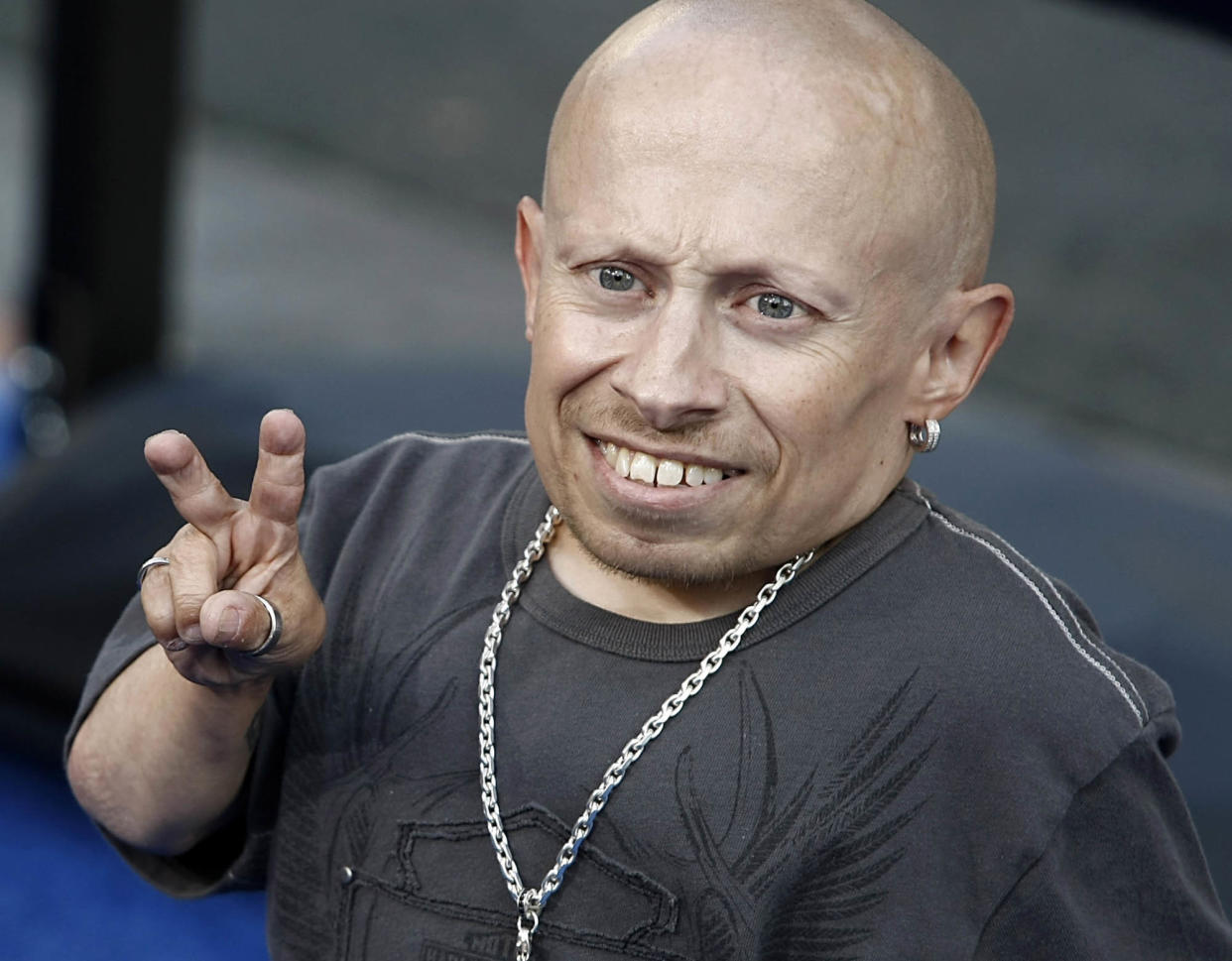 Verne Troyer (Credit: AP Photo/Dan Steinberg)