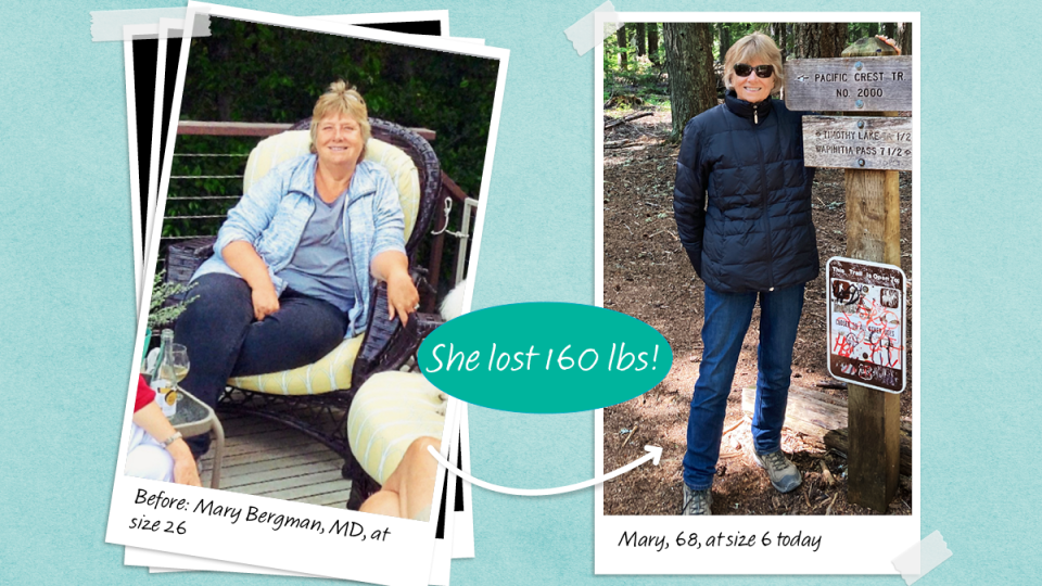 before and after photos of Mary Bergman, MD, 68, who lost 160 lbs with group walking