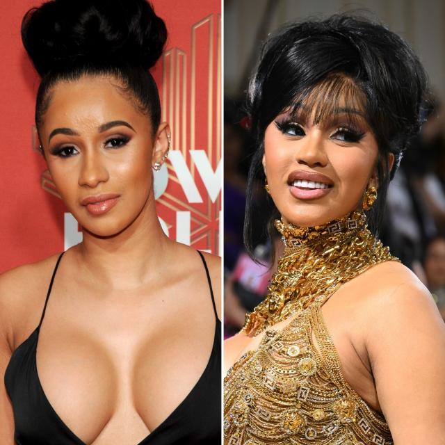 Plastic Surgery Gone Wrong: Celebs Who Regret Going Under the