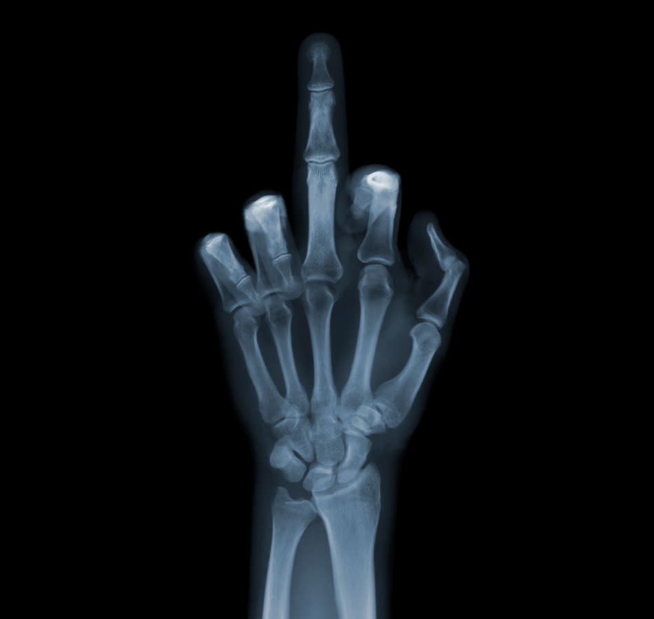 Fascinating X-ray photographs by Nick Veasey svkg 210612