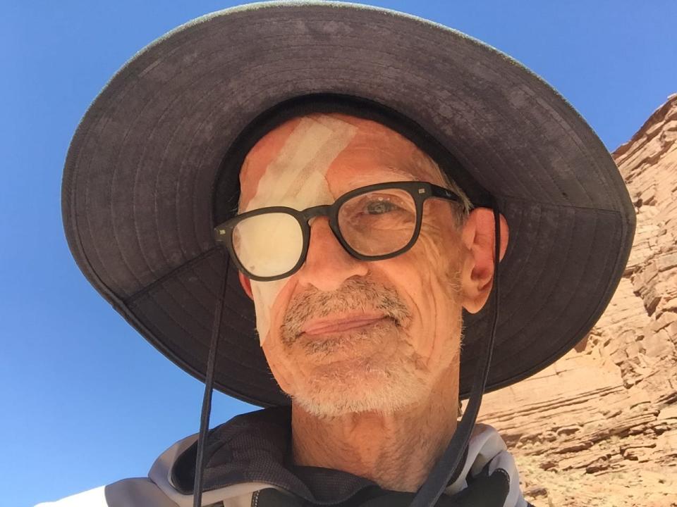 Columnist E.J. Montini scratched his cornea on a rafting trip down the Colorado River.