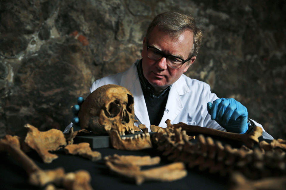 In this Wednesday, March 26, 2014 photo, Don Walker, a human osteologist with the Museum of London, poses for photographers, with one of the skeletons found by construction workers under central London's Charterhouse Square. Twenty-five skeletons were uncovered last year during work on Crossrail, a new rail line that's boring 13 miles (21 kilometers) of tunnels under the heart of the city. Archaeologists immediately suspected the bones came from a cemetery for victims of the bubonic plague that ravaged Europe in the 14th century. The Black Death, as the plague was called, is thought to have killed at least 75 million people, including more than half of Britain's population. (AP Photo/Lefteris Pitarakis)