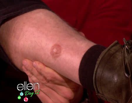 And another.... Cooper's fifth 'nipple'. Photo: The Ellen DeGeneres Show