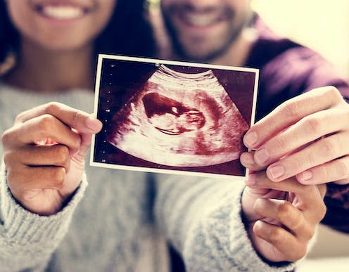 <span class="caption">Turns out it is a sterile environment after all.</span> <span class="attribution"><a class="link " href="https://www.shutterstock.com/image-photo/happy-couple-pregnancy-news-1082692088" rel="nofollow noopener" target="_blank" data-ylk="slk:Rawpixel/Shutterstock;elm:context_link;itc:0;sec:content-canvas">Rawpixel/Shutterstock</a></span>