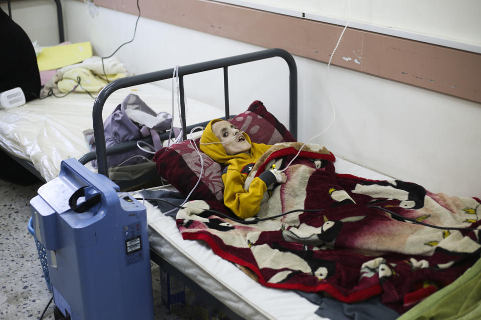 FILE - A 10-year-old Palestinian boy, Yazan al-Kafarna, who was born with cerebral palsy, lies at a hospital in Rafah, March 3, 2024. Yazan died due to what his doctor said was extreme muscle wastage caused primarily by a lack of food. Catastrophic hunger is so dire in two world hotspots that famine is imminent in northern Gaza and approaching in Haiti, with hundreds of thousands of people in both places struggling to avoid starvation, according to international food security experts and aid groups. (AP Photo/Hatem Ali, File)