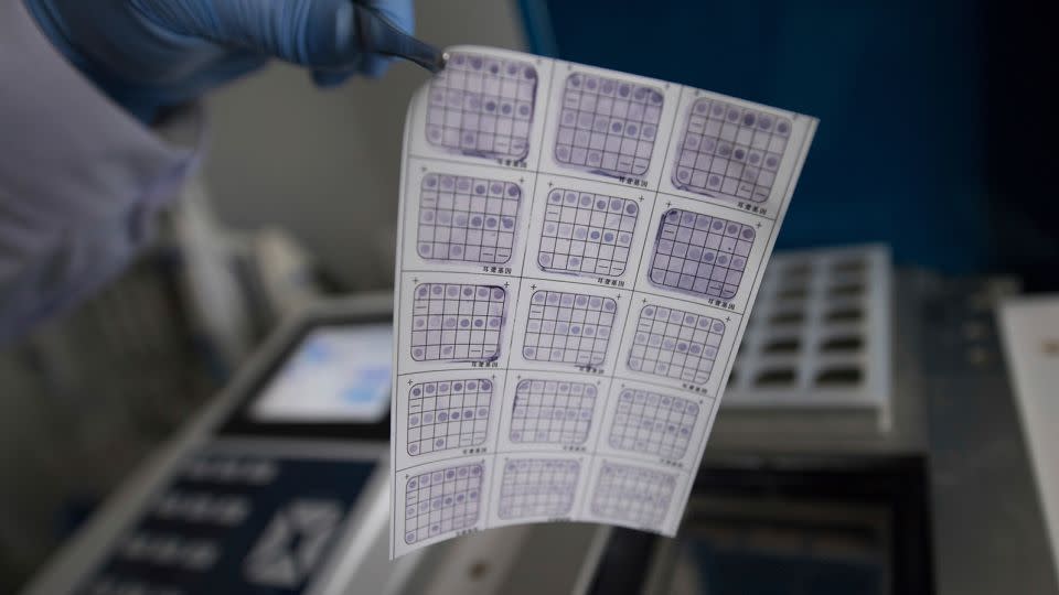 A medical worker performs genetic testing on embryos at the Shanxi Province Reproductive Science Institute in Taiyuan, China, on November 29, 2018. - Wei Liang/ICHPL Imaginechina/AP