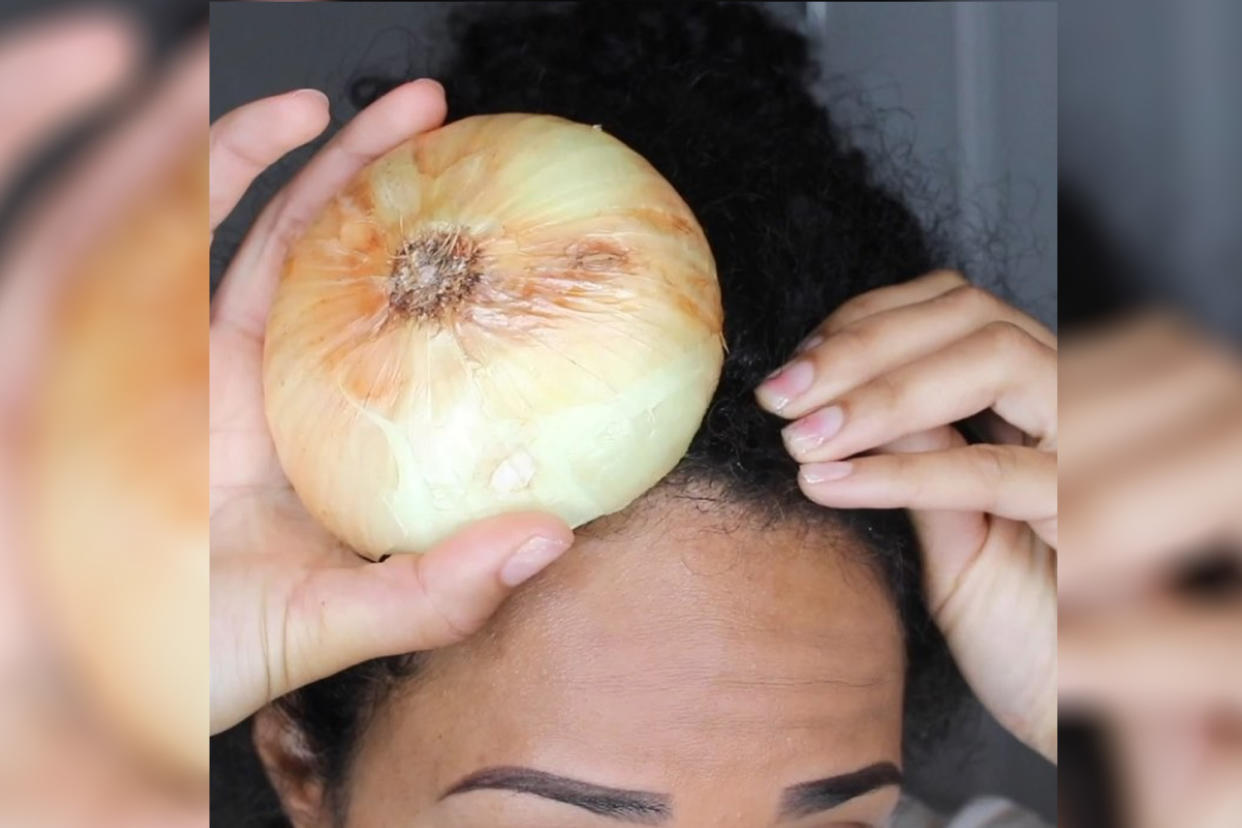 One beauty blogger says that onions and garlic help grow hair. (Photo: Instagram/amberjanielle)