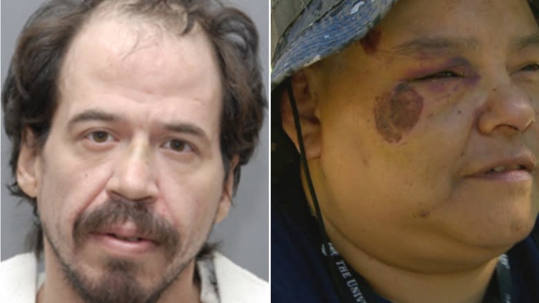 Pair arrested for assault that left McLaren Hotel worker's ears partly bitten off