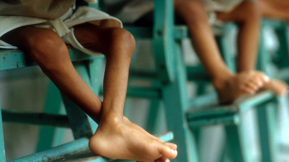 La mitad de todas las muertes mundiales de chicos menores de 5 años se deben a la desnutrición.