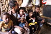 Yemeni boy fights malnutrition as hunger stalks nation's children