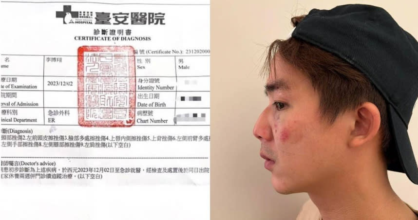 34歲男星李博翔曾參與多部偶像劇演出，沒想到近日因一場誤會，被痛扁成豬頭。（圖／李博翔臉書）