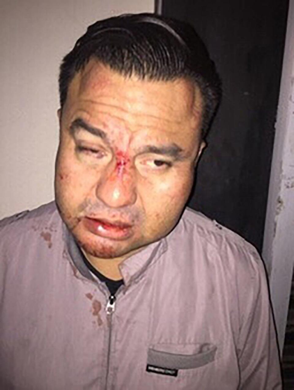 <div class="inline-image__caption"><p>Edwin Salgado after being beaten in Mexico.</p></div> <div class="inline-image__credit">Reyes Mata III</div>