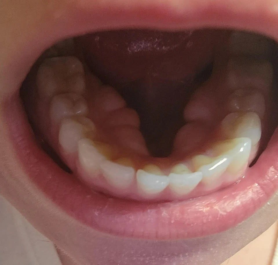 closeup of the person's mouth