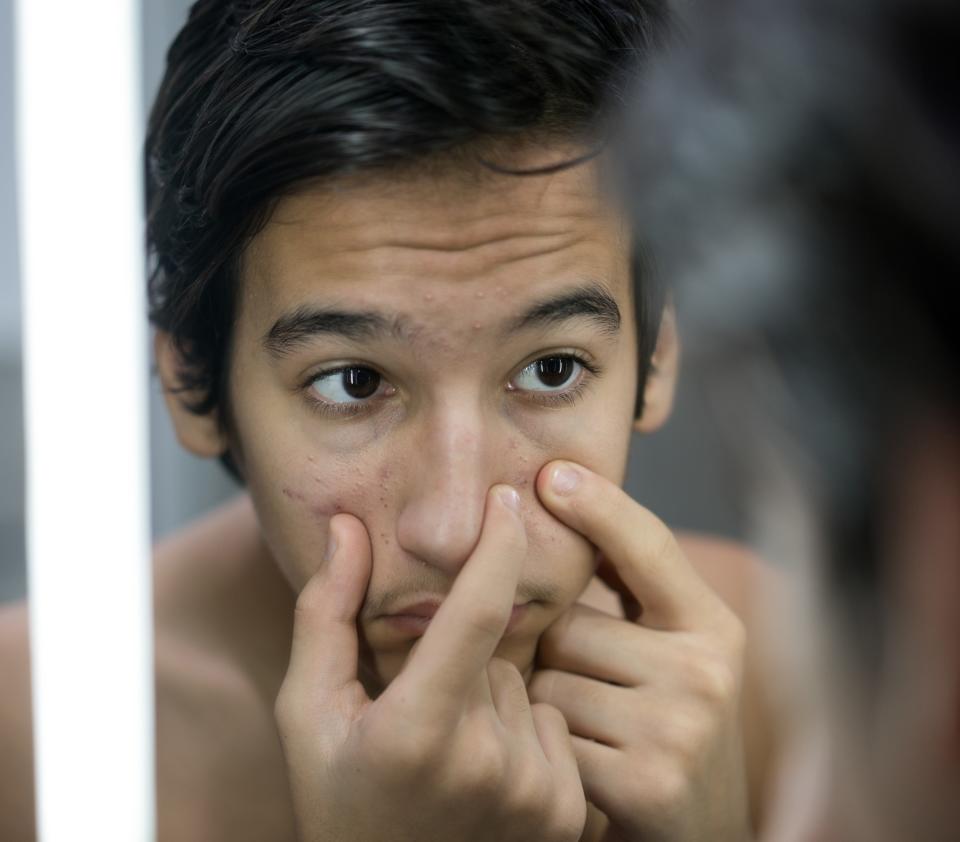 Photo of a guy looking at his skin