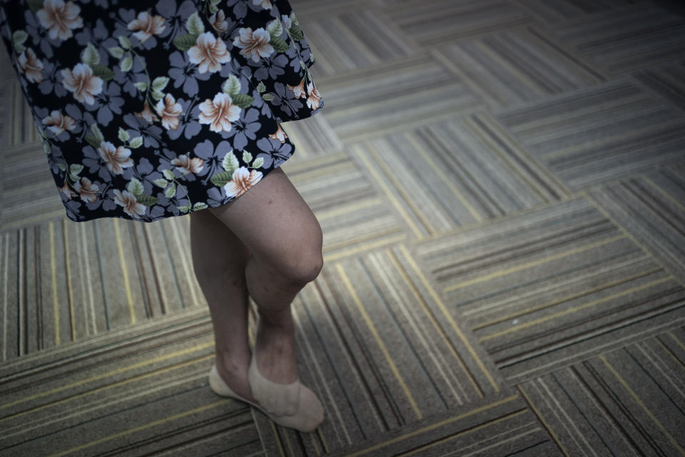 Lune Loh, 25, a transgender woman, speaks to a friend in Singapore, on Friday, Aug. 19, 2022. Loh is still healing from the wounds of her military past. And she finds herself grappling with questions about her future: Like whether any company will ever employ her, or whether she will ever be able to have a biological child, all because her government refuses to see her for who she is. (AP Photo/Wong Maye-E)