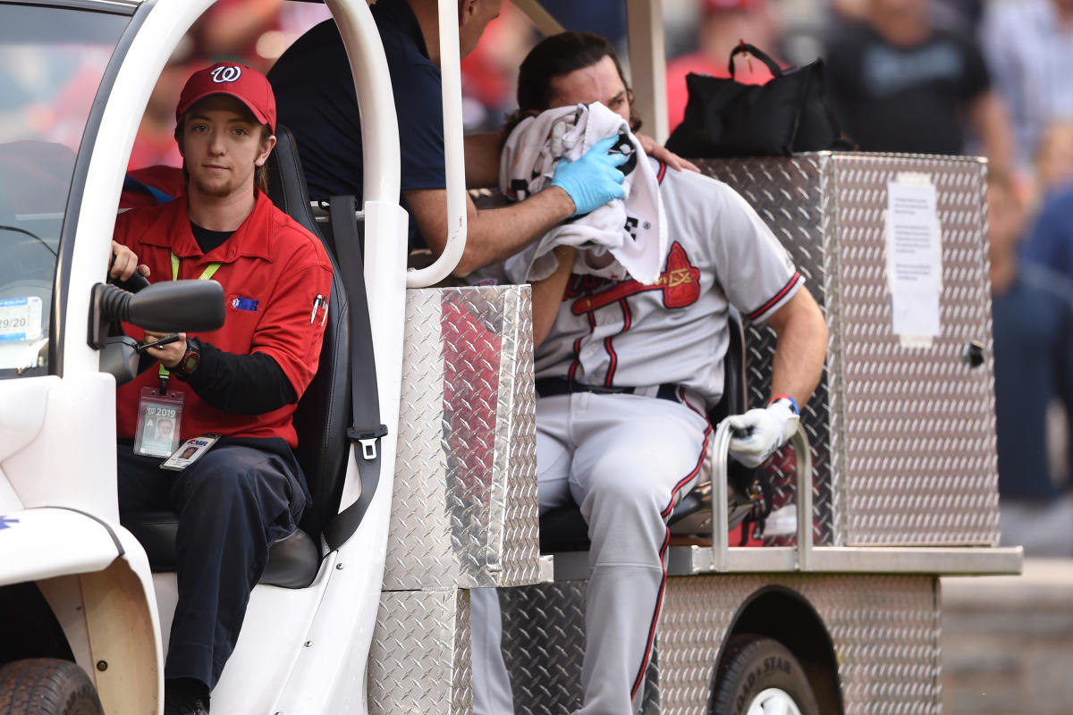 Atlanta Braves Player Hit in Face By 90 MPH Pitch