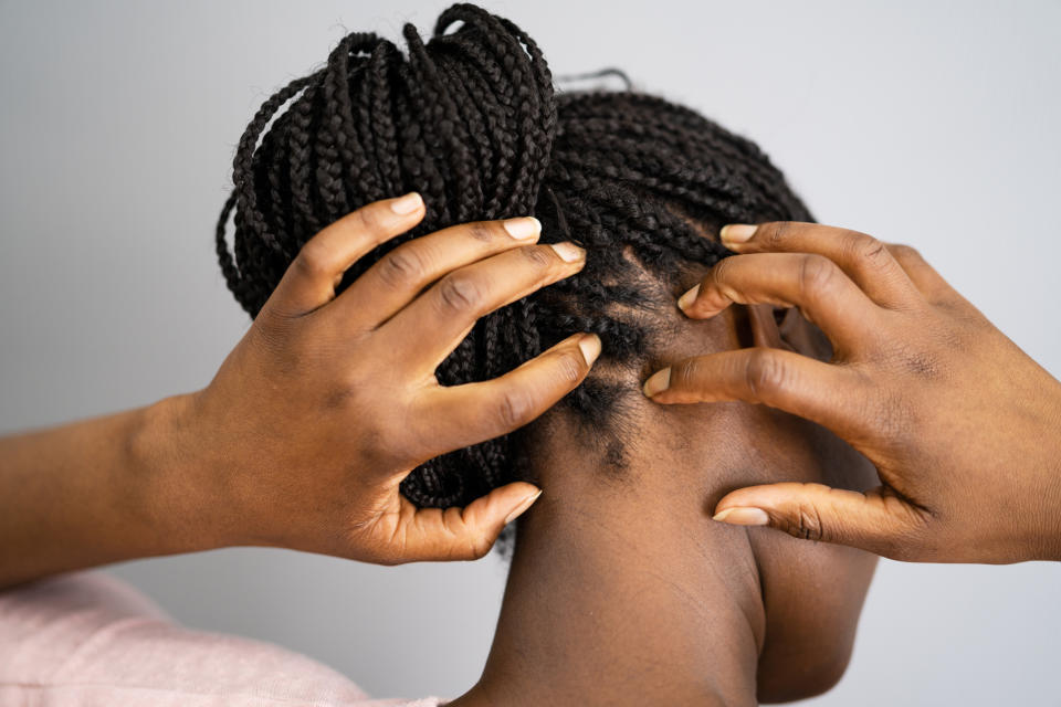 A Black woman itching her head/ scalp