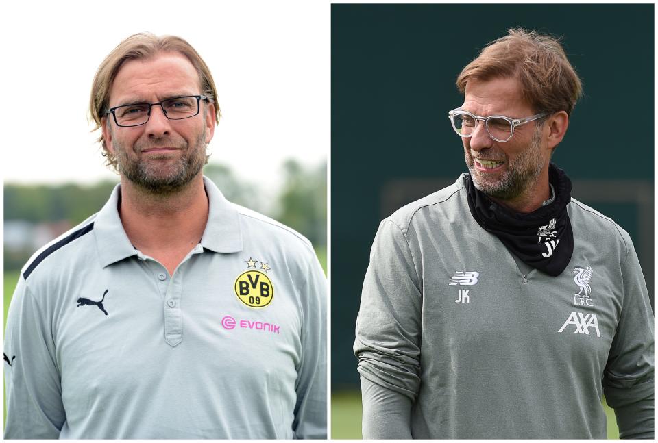 También lucía melena hace unos años Jürgen Klopp, aunque no podía disimular sus entradas. El técnico del Liverpool se sometió también a un trasplante de pelo en 2013. “Ha quedado molón, ¿no?”, reconoció públicamente con su habitual sentido del humor. (Foto: Patrik Stollarz / AFP / Getty Images / John Powell / Liverpool / Getty Images).