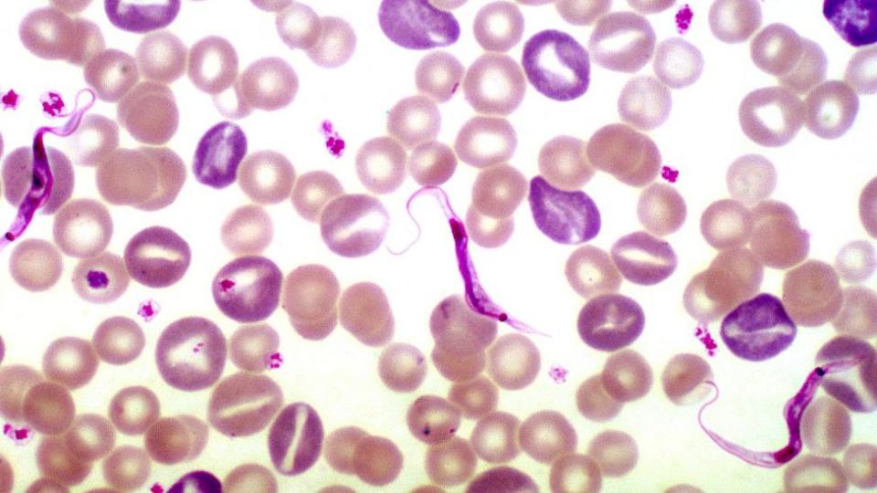 Vista del virus Trypanosoma cruzi.