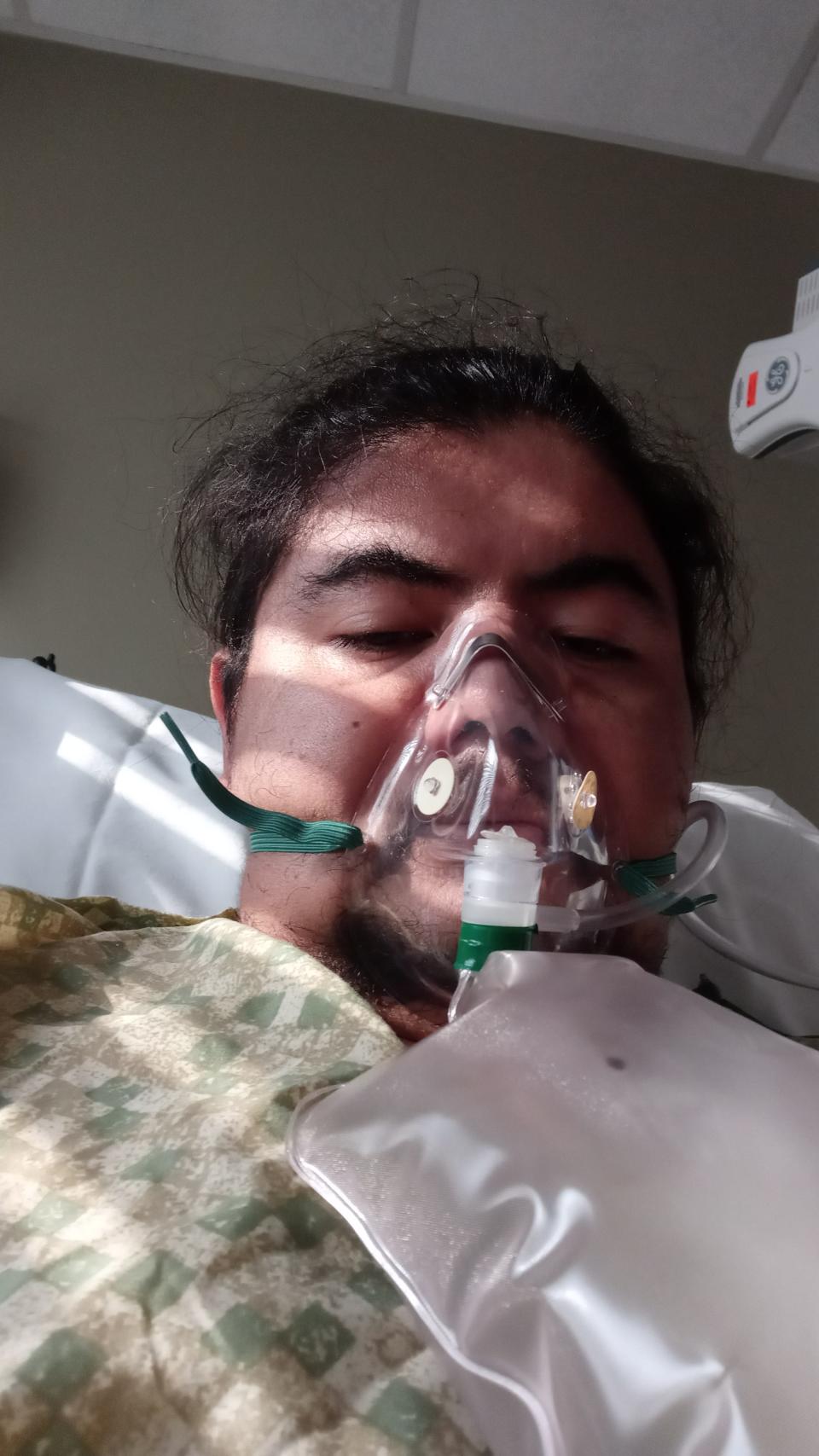 When Manuel Chimal finally was admitted in the hospital, he needed oxygen, but eventually his lungs couldn't keep up with what he needed, and he had to be put on a ventilator.