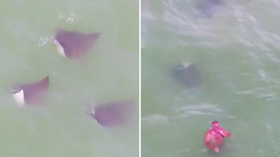 Pictured is an extremely sunburnt man next to a pod of stingrays at a Florida beach. 