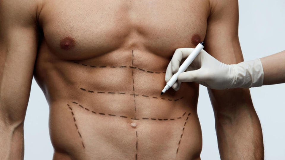 Cosmetic Surgery Procedures