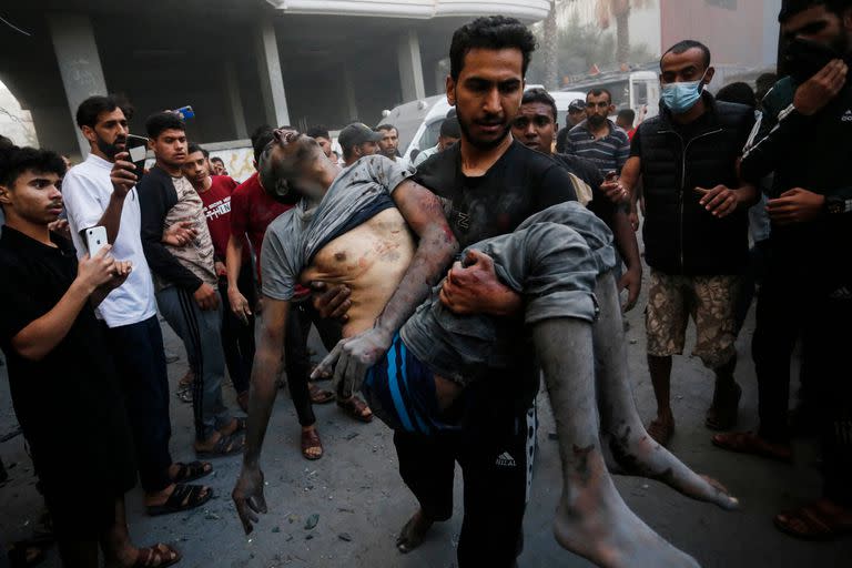 Un herido palestino en Deir al-Balah, en la Franja de Gaza. (Mohammed Faiq / AFP)