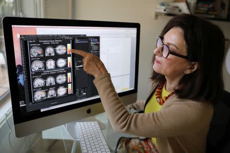 Dr. Ivanka Savic points to a study on the screen of her computer at her home in Los Angeles, California, U.S. June 30, 2017. REUTERS/Lucy Nicholson